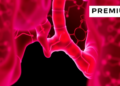 Cancer Therapy Reshapes Mutation Competition in Healthy Esophageal Tissue