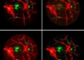 Deep learning segments retinal blood vessels in fluorescein angiography images