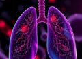 Dimethyl phthalate triggers oxidative stress and inflammation in lung cells