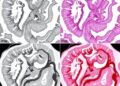 Enhanced INFO algorithm enables multi-threshold segmentation of colorectal cancer histopathology images