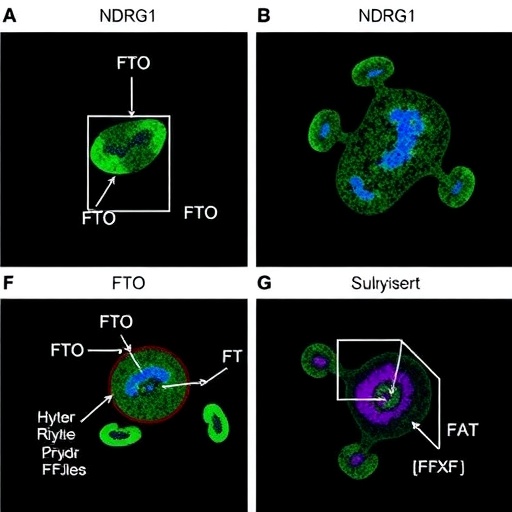 FTO Loss Protects Vascular Cells in Obesity Hypertension via NDRG1 Methylation