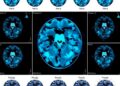 Feature-weighted PCNN classifies big medical data efficiently using MapReduce