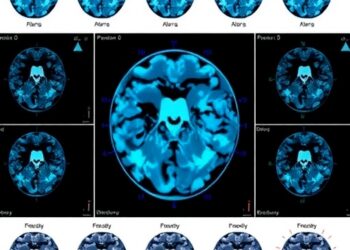 Feature-weighted PCNN classifies big medical data efficiently using MapReduce