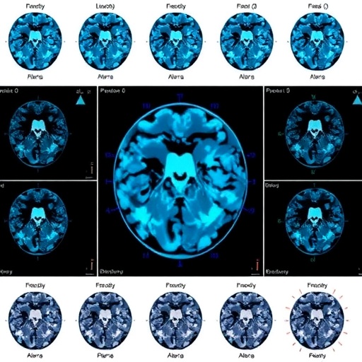 Feature-weighted PCNN classifies big medical data efficiently using MapReduce