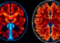 From Lab to Clinic: Mapping the Long Road for Deep Learning in Medical Imaging