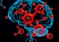 Fullerene derivatives ease brain inflammation after cranial radiation therapy