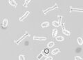 Genomic diversity and antibiotic resistance in porcine F18 E. coli strains