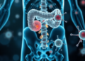 Gut Microbe Metabolites May Reach Bone Cells Through an AKT1 Signaling Network