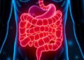 Gut Microbiota Metabolites Show Promise Against Disc Degeneration