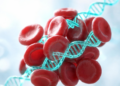 Hidden RNA Regulators Uncovered in Antiphospholipid Syndrome Blood Cells