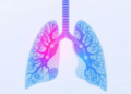 Hybrid AI Model Brings Balance to Automated Lung Sound Diagnosis