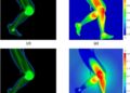 Hybrid diffusion-routing models capture long-range knee contact mechanics