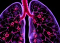 Immortalized lung macrophage cell line keeps primary-cell identity, offering new tool for respiratory research