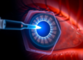 Injectable light-sensitive nanoparticles restore light responses in blind retinas