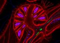 Losing desmoplakin in lung epithelium triggers fibrotic Wnt signaling in vitro