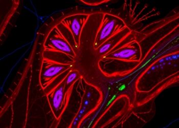 Losing desmoplakin in lung epithelium triggers fibrotic Wnt signaling in vitro