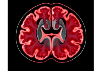 MRI Reveals Hidden Architecture Inside Plant-Based Meat