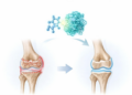 MYDGF as a telomerase activator and therapeutic target for osteoarthritis