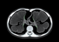 Mamba-Based AI Sharpens Medical Image Segmentation With Position Awareness and Dynamic Upsampling