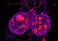 Mapping mammary cell diversity in women at high breast cancer risk
