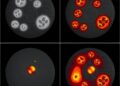 Mel-DEPTHS: new benchmark dataset for melanoma skin and tumor segmentation