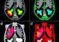 Multi-domain collaborative learning improves medical image segmentation via MDCL-UNet
