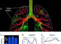 Mutant TP53 traps FOXP3, disrupting PD-L1 control and fueling immune evasion in lung cancer