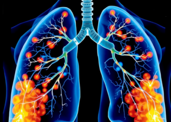 New AI Method Fuses Expert Opinions to Map Lung Vessels With Calibrated Confidence