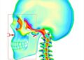 New framework automates Cobb angle measurement via two-stage anatomical reasoning