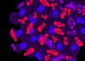 Predicting pathology response in triple-negative breast cancer using tumor-infiltrating lymphocytes