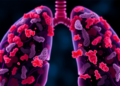 RNA Tag METTL3 Drives Lung Scarring by Destabilizing a Key Fat-Droplet Protein