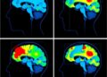 Scoping review maps cortical activation during swallowing tasks using fNIRS