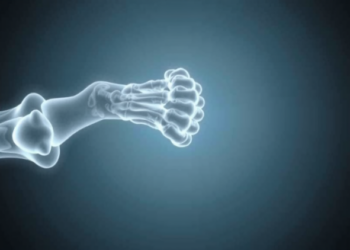 Soy Compound Genistein Shows Promise Against Diabetes-Linked Bone Loss