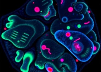 TLR4/MYD88 pathway dysregulation drives breast cancer progression in Egyptian women