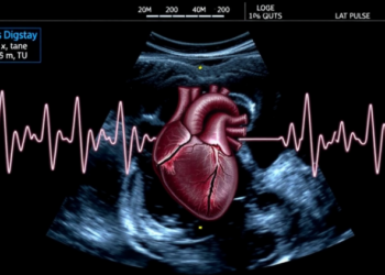 Ultrasound Pulses Steer the Heart’s Rhythm Under Live Imaging Guidance