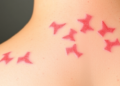 Vitamin D Compound Tames Psoriasis by Switching Off a Hidden Inflammatory Gene