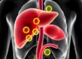 Vitamin E reduces fat buildup and oxidative stress in liver disease model