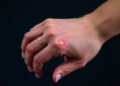 Wrist-Worn Sensor Tracks Stroke Recovery With Machine Learning Precision
