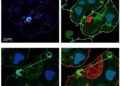 ZUP1 drives cisplatin resistance and Treg signaling in lung cancer