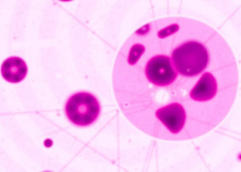 AI Can Spot Leukemia Cells on Blood Smears, But One Blast Type Keeps Slipping Through