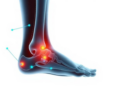 AI Shows Striking Accuracy in Diagnosing Chronic Ankle Instability, Review Finds