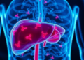 Blocking a Calcium Sensor Could Weaken Liver Cancer Cells