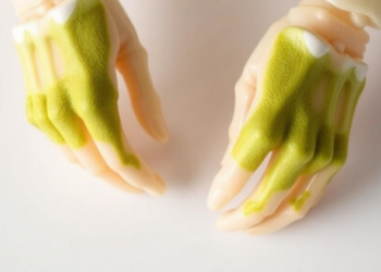 Green Tea Coating Turns Artificial Joints Into Infection-Fighting Implants