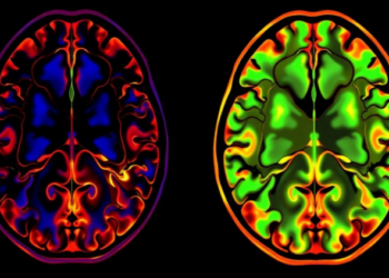 New Algorithm Reads Molecular Maps to Untangle Isotopic Patterns in Tissue Imaging