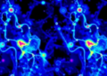 Raman Imaging Team Defends Label-Free Spectral Maps Against Criticism