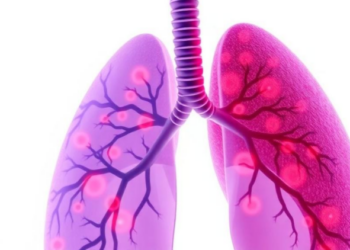 Seven Tiny RNAs Emerge as Potential Keys to Aggressive Lung Cancer Survival