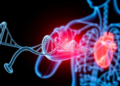Silenced Gene Accelerates Heart Failure After Heart Attack, Study Finds