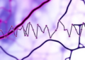 Truncated ALK Transcript in Solid Tumours: Hyped Biomarker or Biological Enigma?