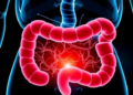 Two Probiotic Strains Calm Gut Inflammation by Taming the NLRP3 Inflammasome