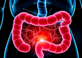 Two Probiotic Strains Calm Gut Inflammation by Taming the NLRP3 Inflammasome